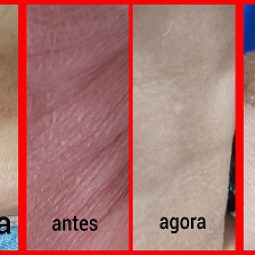 A cura de Naamã e a minha cura (texto)